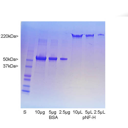 Coomassie brilliant blue stained SDS-PAGE gel of pig pNF-H preparation. First lane shows molecular weight standards of indicated molecular size. Next three lanes show BSA at 10, 5 and 2.5 μg respectively. Next three show the indicated volumes of the pNF-H preparation. The pNF-H was isolated from pig spinal cord using Triton/sucrose extraction method of Leung and Liem as far as the 6M urea solubilization and batch ion exchange chromatography on hydroxyapatite step. The material was then fractionated using a phosphate gradient of 10mM to 300mM on DEAE-cellulose in 6M urea at pH=7.5. The pNF-H elutes cleanly at about 50mM phosphate as shown. The pig pNF-H runs on SDS-PAGE with an apparent molecular weight of 220kDa.